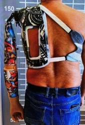 Active (traction) shoulder prosthesis
