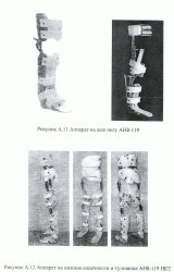Lower limb and torso orthopaedic apparatus AN8-119 tubing