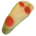 Diabetic foot model, item S19