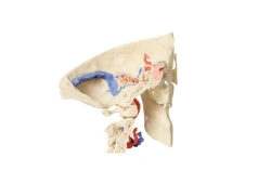 Expanded temporal bone model, 11119