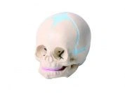 Model of child's skull, 11114