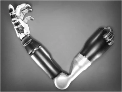 Shoulder prosthesis with external energy source PP9-70-V