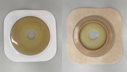 Rehabilitation device for stomical use in colostomies, ileostomies and urostomies: flat plate, convex plate.
