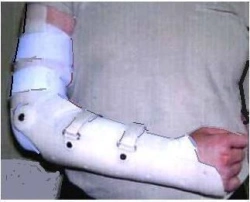 Wrist and elbow joint apparatus