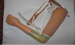 Active (traction) shoulder prosthesis