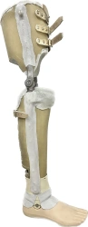 Tibia non-modular prosthesis, including for underdevelopment, PN3-14