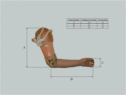 Shoulder prosthesis with microprocessor control system