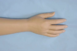 Cosmetic hand prosthesis, including partial and partial dislocation of the hand PR0-21