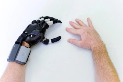 Hand prosthesis with microprocessor control