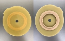 Rehabilitation device for stomical use in colostomies, ileostomies and urostomies: flat plate, convex plate.