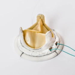 Biological heart valve prosthesis "MEDINGE-BIO" according to TU 9444-018-27771122-2014.