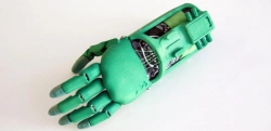 Active prosthesis of the hand, including partial and partial dislocation of the hand