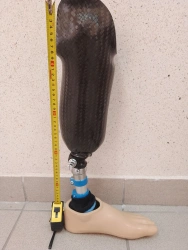 8-07-09 Modular tibial prosthesis, including underdevelopment.