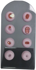 Models of cervical pathology, ZG