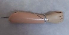 Active (traction) forearm prosthesis