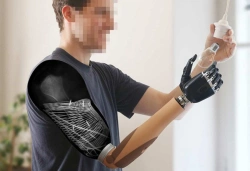 Prosthesis after shoulder dislocation with electromechanical drive and contact control system