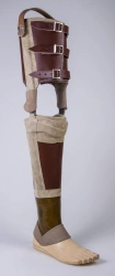 Tibia non-modular prosthesis, including congenital underdevelopment PN3-42
