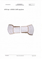 Therapeutic multilayer device on the basis of metallised film "RITM-ULM" / Patellar kneepads "cups".