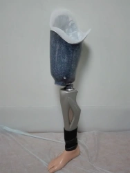 Modular hip prosthesis with microprocessor control