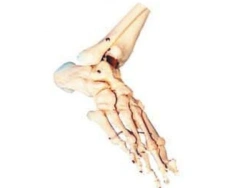 Bones of the foot, item 11133