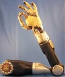 Prosthesis after shoulder dislocation with electromechanical actuator and contact control system PR8-MPU.1