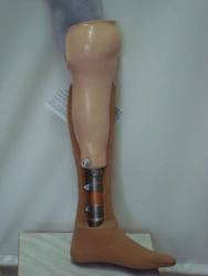 Modular tibia prosthesis, including underdevelopment PN3-01-OC