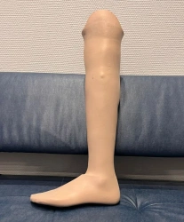 Modular tibia prosthesis, including for congenital deficiency