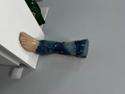 8-07-01 Foot prosthesis