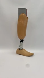 Modular tibial prosthesis, including those with underdevelopment