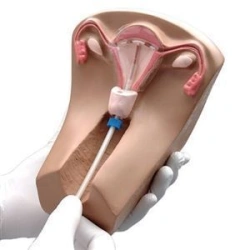 Intrauterine contraception trainer, B3