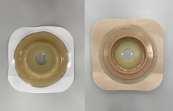 Rehabilitation device for stomical use in colostomies, ileostomies and urostomies: flat plate, convex plate.
