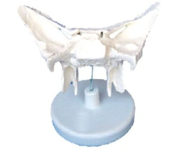 Enlarged model of sphenoid bone, 11120