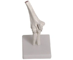 Bones of the elbow joint, item 11201-2