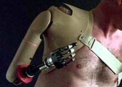 Prosthesis after shoulder dislocation with electromechanical actuator and contact control system, PR8-VOB.