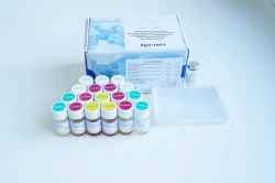 Reagent kit for diagnostics of urogenital infections and determination of sensitivity to antibiotics (Uro-test)