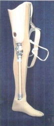 Modular hip prosthesis, including those with congenital underdevelopment PH6-03-OC