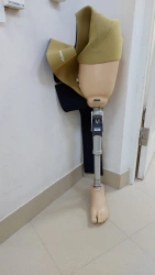 Modular hip prosthesis, including for congenital underdevelopment PN6-OB