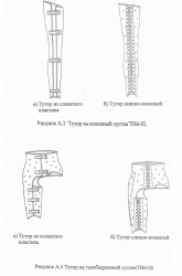 Knee joint tourniquet TH4-02