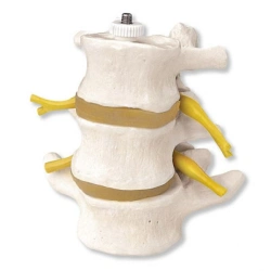 Model of three lumbar vertebrae, 11109-2