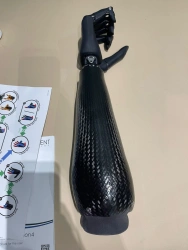 Forearm prosthesis with microprocessor control