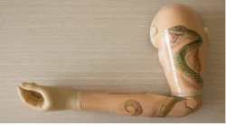 Shoulder prosthesis with microprocessor control system