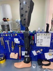 Modular hip prosthesis with microprocessor control