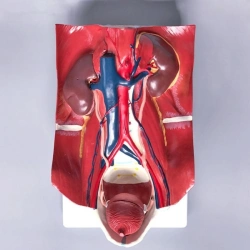 Urinary system and posterior abdominal wall, U4004