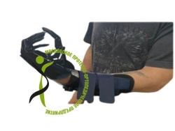 Active hand prosthesis, including partial and partial disarticulation of the hand PR0-22