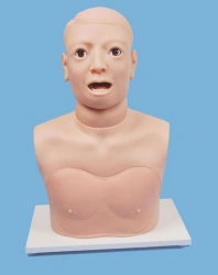 Focal nodular pattern of larynx, CS6276