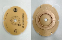 Rehabilitation device for stomical use in colostomies, ileostomies and urostomies: flat plate, convex plate.