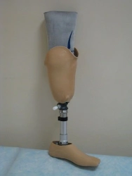 Modular tibial prosthesis, including those with underdevelopment