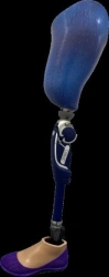 Modular hip prosthesis, including for congenital underdevelopment