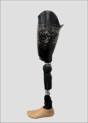Modular hip prosthesis with external energy source PN6-78