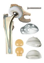 Hip joint endoprosthesis according to TU 9438-001-49346483-2005